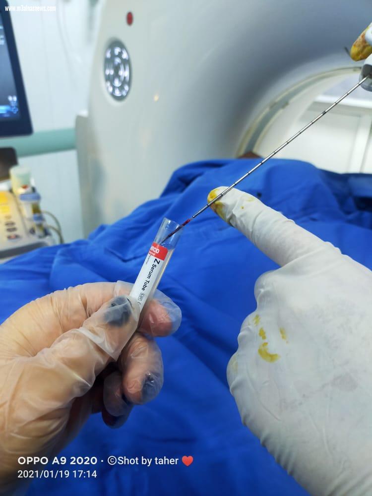 الدكتور محمود غلاب وحديث عن دور الأشعة التداخلية وأورام الكبد وأحدث وسائل علاج سرطان الكبد... صور