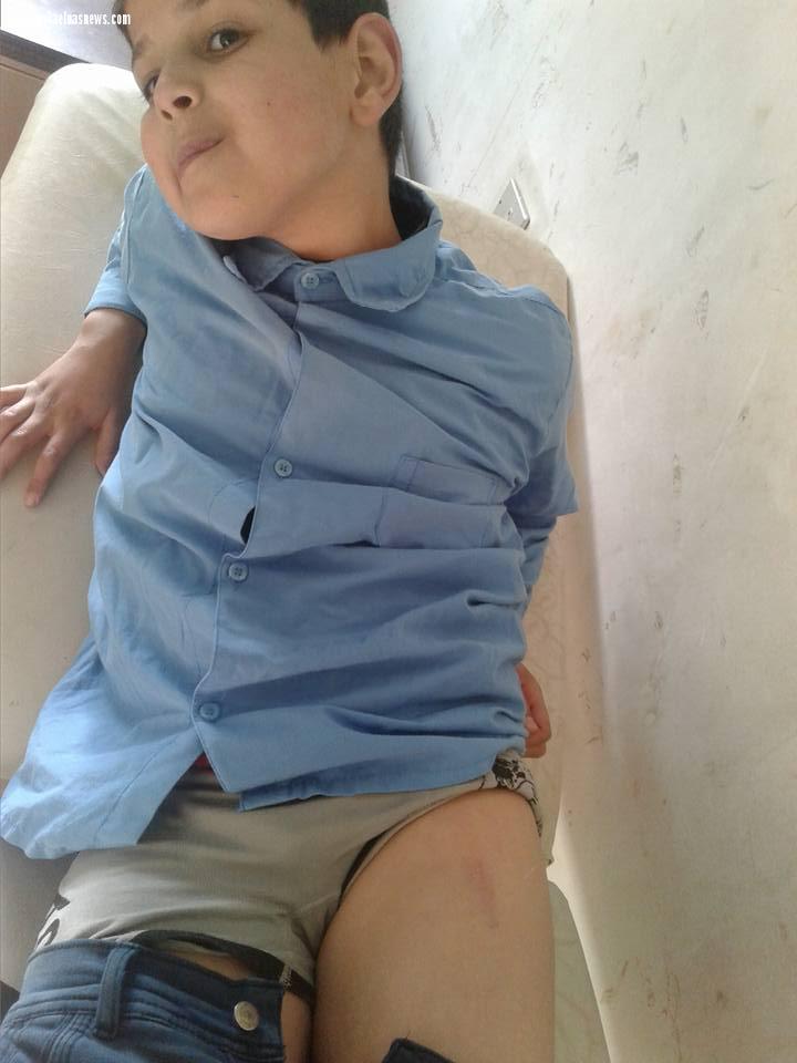 ولى أمر فى بلطيم يتهم معلمة بضرب نجله وإصابته لعدم حصوله على درس خصوصى
