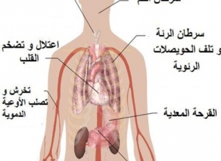 علماء الصحة يطالبون بعلانية الاجتماع التاسع لمؤتمر أطراف اتفاقية مكافحة التبغ